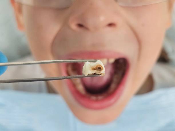 Best Emergency Root Canal Therapy in Delmont, PA